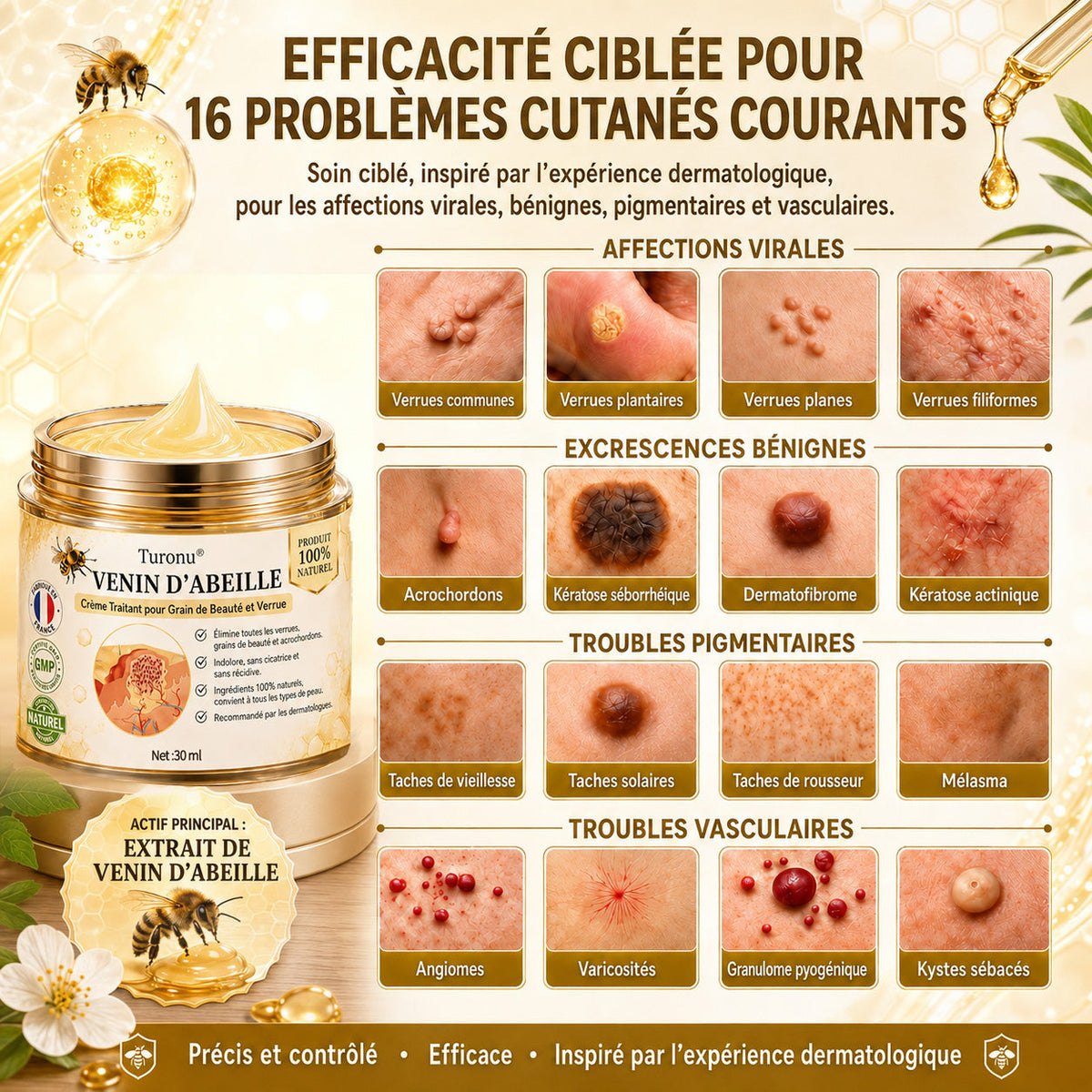 Turonu®🎉 tratamiento avanzado con veneno de abeja contra las verrugas y las imperfecciones de la piel 👨‍⚕️ Inspirado en la ciencia dermatológica | Cuidado localizado en casa