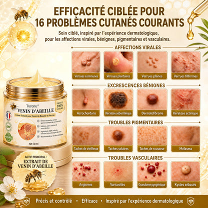 Turonu®🎉 tratamiento avanzado con veneno de abeja contra las verrugas y las imperfecciones de la piel 👨‍⚕️ Inspirado en la ciencia dermatológica | Cuidado localizado en casa