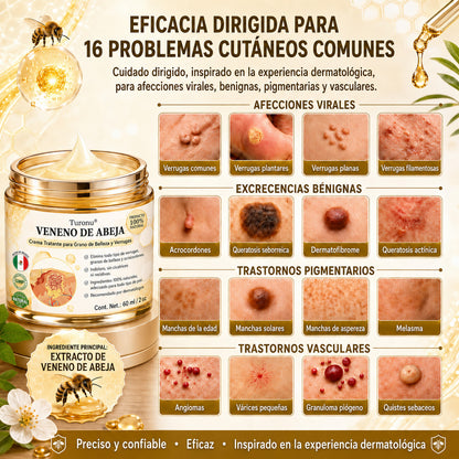🧚‍♀️Turonu® tratamiento avanzado con veneno de abeja contra las verrugas y las imperfecciones de la piel 👨‍⚕️ Inspirado en la ciencia dermatológica | Cuidado localizado en casa