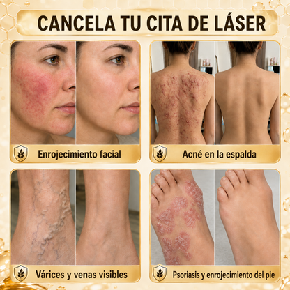 🧚‍♀️Turonu® tratamiento avanzado con veneno de abeja contra las verrugas y las imperfecciones de la piel 👨‍⚕️ Inspirado en la ciencia dermatológica | Cuidado localizado en casa