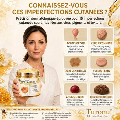 Turonu®🎉 tratamiento avanzado con veneno de abeja contra las verrugas y las imperfecciones de la piel 👨‍⚕️ Inspirado en la ciencia dermatológica | Cuidado localizado en casa