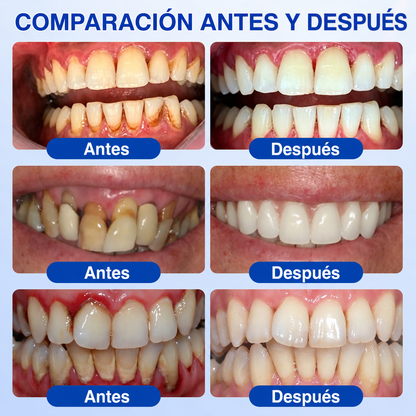 🇩🇪👨‍⚕️🦷✨GarageLine® GumRevive: gel reparador periodontal