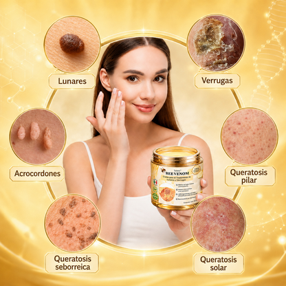 🏆Turonu® Tratamiento Avanzado con Veneno de Abeja para Verrugas e Imperfecciones de la Piel 👨‍⚕️ Inspirado en la ciencia dermatológica | Cuidado localizado desde casa