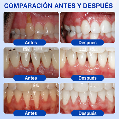 🇩🇪👨‍⚕️🦷✨GarageLine® GumRevive: gel reparador periodontal