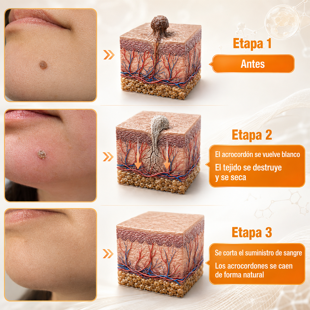 🏆Turonu® Tratamiento Avanzado con Veneno de Abeja para Verrugas e Imperfecciones de la Piel 👨‍⚕️ Inspirado en la ciencia dermatológica | Cuidado localizado desde casa