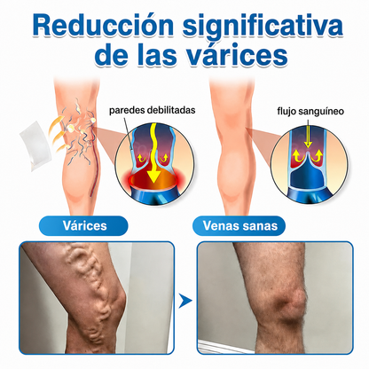 🇲🇽✨ ¿Venas marcadas en tus piernas? Healrize® VeinTarget Parche de Nanomicroagujas para un cuidado avanzado 👩‍⚕️