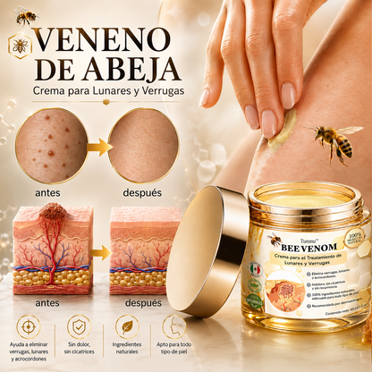 🏆Turonu® Tratamiento Avanzado con Veneno de Abeja para Verrugas e Imperfecciones de la Piel 👨‍⚕️ Inspirado en la ciencia dermatológica | Cuidado localizado desde casa