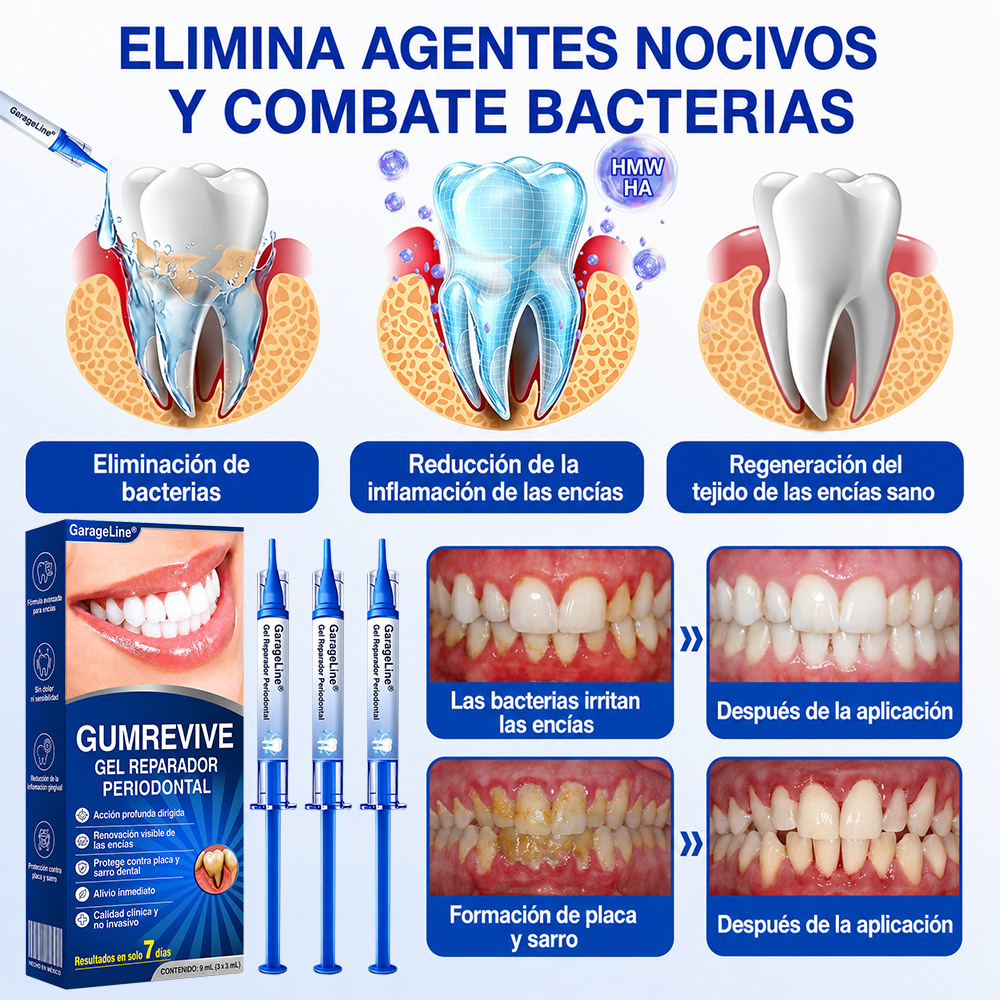 🇩🇪👨‍⚕️🦷✨GarageLine® GumRevive: gel reparador periodontal