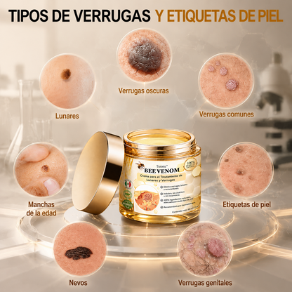 🏆Turonu® Tratamiento Avanzado con Veneno de Abeja para Verrugas e Imperfecciones de la Piel 👨‍⚕️ Inspirado en la ciencia dermatológica | Cuidado localizado desde casa