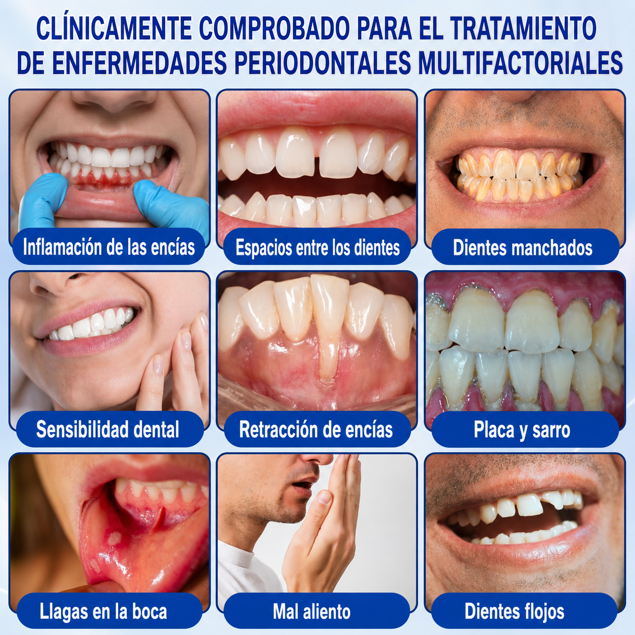 🇩🇪👨‍⚕️🦷✨GarageLine® GumRevive: gel reparador periodontal