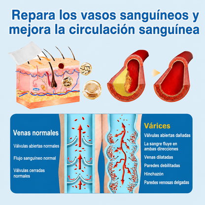 🇲🇽✨ ¿Venas marcadas en tus piernas? Healrize® VeinTarget Parche de Nanomicroagujas para un cuidado avanzado 👩‍⚕️