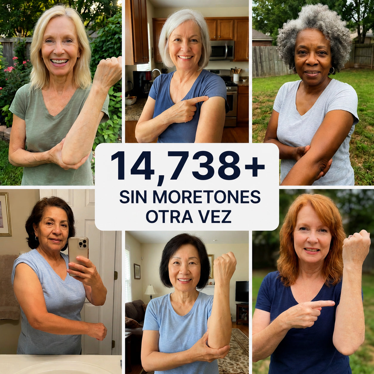 💥¡Más de 100,000 vendidos!💕- CureVivo® Crema Reparadora de Moretones y Fortalecedora de la Piel