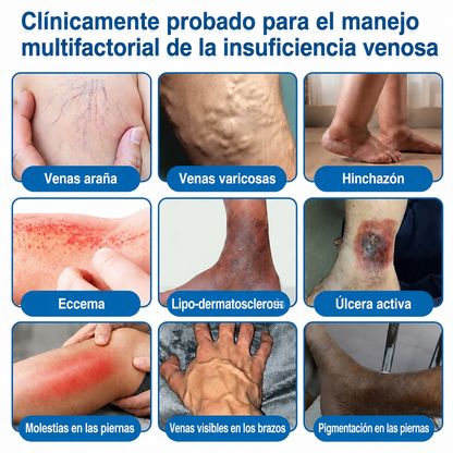 🇲🇽🏆Rollo de parches con microagujas Trilumia® VeinRepair ⚡ Alivio inmediato, resultados a largo plazo