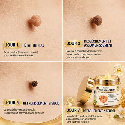 Turonu®🎉 tratamiento avanzado con veneno de abeja contra las verrugas y las imperfecciones de la piel 👨‍⚕️ Inspirado en la ciencia dermatológica | Cuidado localizado en casa