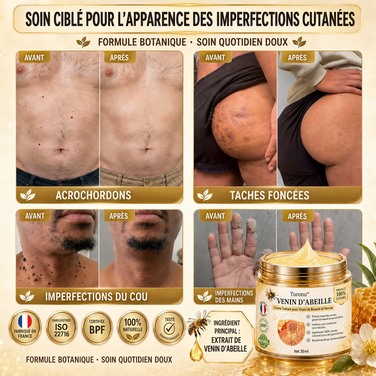 Turonu®🎉 tratamiento avanzado con veneno de abeja contra las verrugas y las imperfecciones de la piel 👨‍⚕️ Inspirado en la ciencia dermatológica | Cuidado localizado en casa
