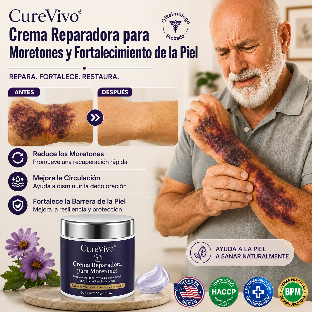 💥¡Más de 100,000 vendidos!💕- CureVivo® Crema Reparadora de Moretones y Fortalecedora de la Piel