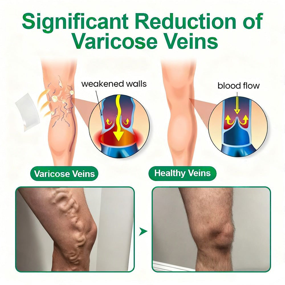 🇺🇸🦅✅Healrize® VeinTarget Microneedle Patch⚡Instant Relief, Long-Term Results 👩‍⚕️