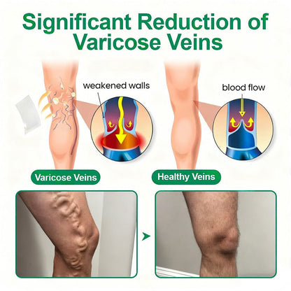 🇺🇸🦅✅Healrize® VeinTarget Microneedle Patch⚡Instant Relief, Long-Term Results 👩‍⚕️