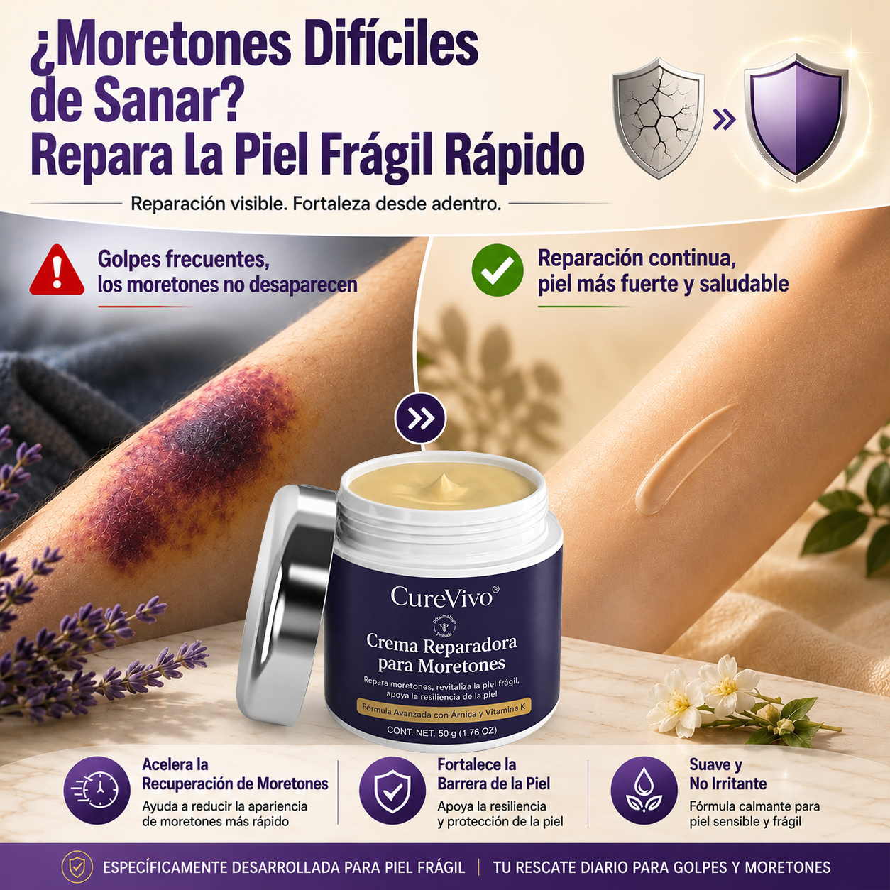 💥¡Más de 100,000 vendidos!💕- CureVivo® Crema Reparadora de Moretones y Fortalecedora de la Piel