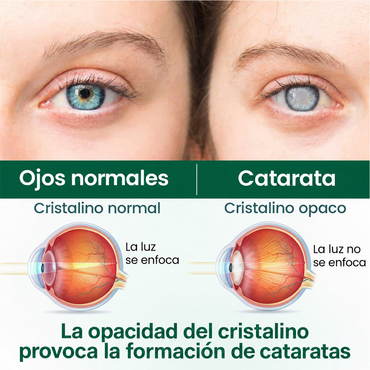 🧑‍⚕️CureVivo® Suero Rodante Ocular Nano Clear Vision – Confort Ocular Profesional y Soporte para la Vista