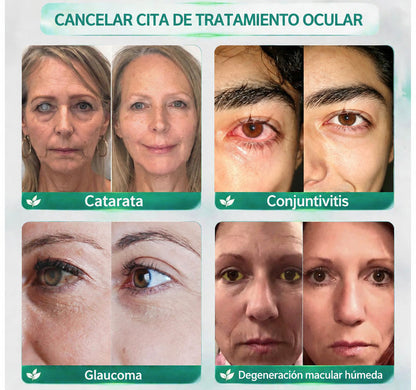 🧑‍⚕️CureVivo® Suero Rodante Ocular Nano Clear Vision – Confort Ocular Profesional y Soporte para la Vista