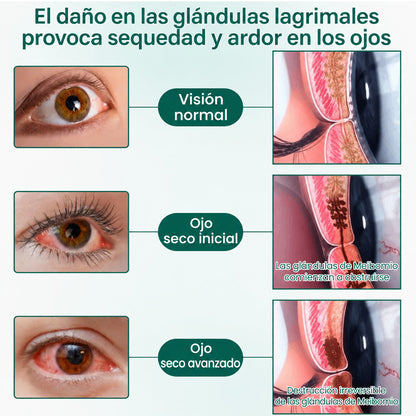 🧑‍⚕️CureVivo® Suero Rodante Ocular Nano Clear Vision – Confort Ocular Profesional y Soporte para la Vista