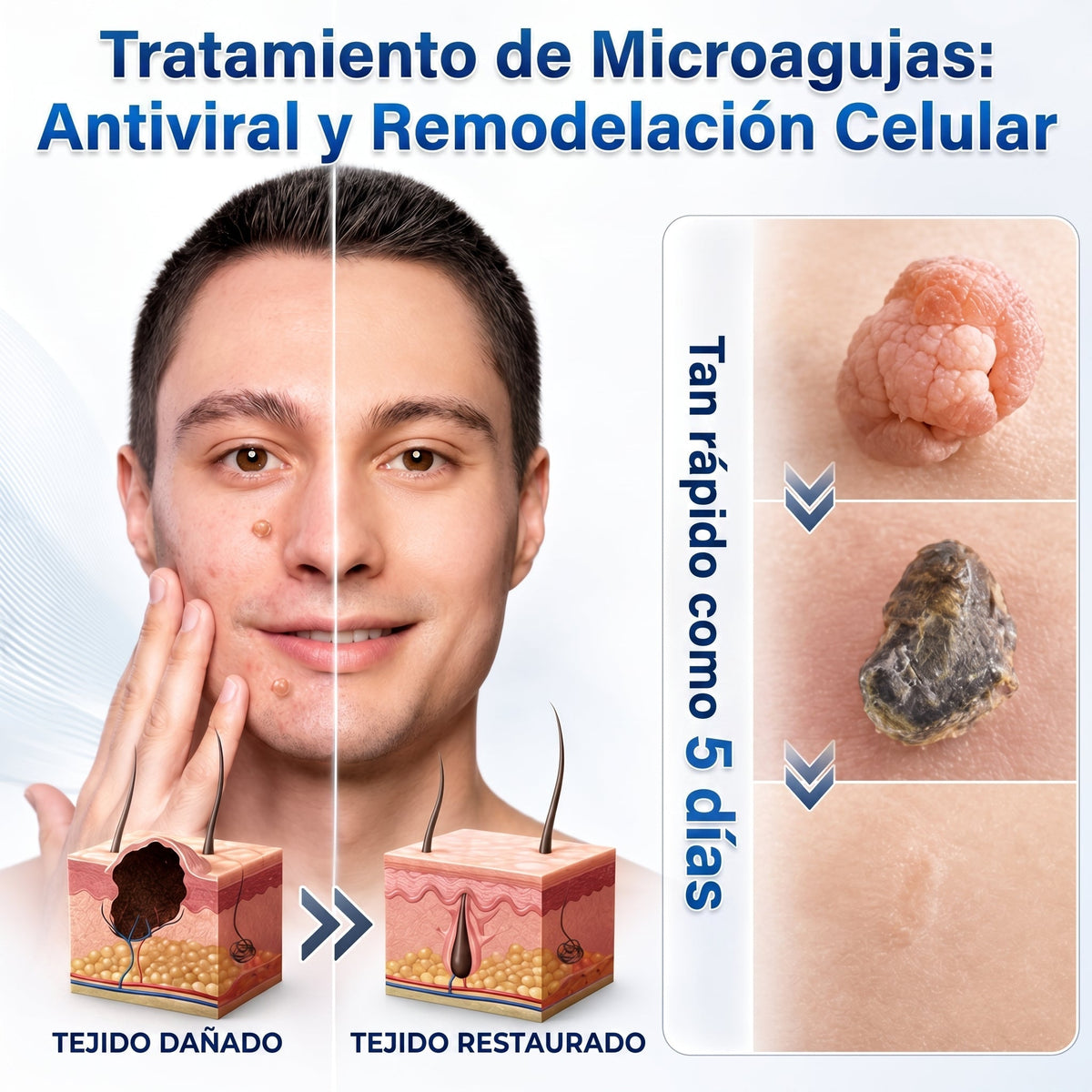 👩‍⚕️🎉𝑻𝒊𝒆𝒏𝒅𝒂 𝑶𝒇𝒊𝒄𝒊𝒂𝒍 | CZTICLE® ☃️ 𝑀𝑖𝑐𝑟𝑜𝑎𝑔𝑢𝑗𝑎𝑠 𝑃𝑖𝑒𝑙 𝐼𝑚𝑝𝑒𝑐𝑎𝑏𝑙𝑒 𝐸𝑙𝑖𝑚𝑖𝑛𝑎𝑐𝑖ó𝑛 𝐷𝑒 𝑉𝑒𝑟𝑟𝑢𝑔𝑎𝑠 𝑃𝑎𝑟𝑐ℎ𝑒 (𝑃𝑎𝑟𝑎 𝑎𝑐𝑟𝑜𝑐𝑜𝑟𝑑𝑜𝑛𝑒𝑠, 𝑝𝑒𝑞𝑢𝑒ñ𝑎𝑠 𝑖𝑚𝑝𝑒𝑟𝑓𝑒𝑐𝑐𝑖𝑜𝑛𝑒𝑠 𝑐𝑢𝑡á𝑛𝑒𝑎𝑠, 𝑣𝑒𝑟𝑟𝑢𝑔𝑎𝑠, 𝑙𝑢𝑛𝑎𝑟𝑒𝑠, 𝑚𝑎𝑛𝑐ℎ𝑎𝑠 𝑑𝑒 𝑙𝑎 𝑒𝑑𝑎𝑑 𝑦 𝑝𝑟𝑜𝑏𝑙𝑒𝑚𝑎𝑠 𝑑𝑒 𝑝𝑖𝑔𝑚𝑒𝑛𝑡𝑎𝑐𝑖ó𝑛.)