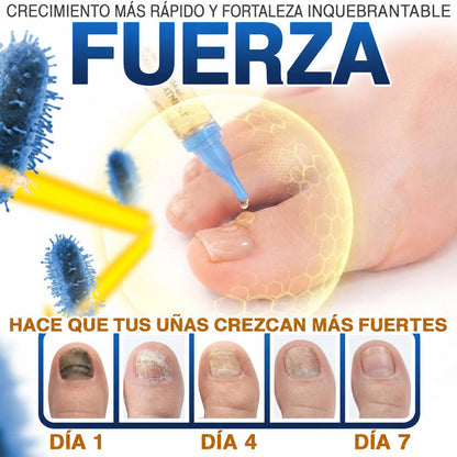 🇲🇽 Turonu® FungiFree 🐝 Cuidado Intensivo para Hongos, Uñas Amarillas, Gruesas y Quebradizas ✨
