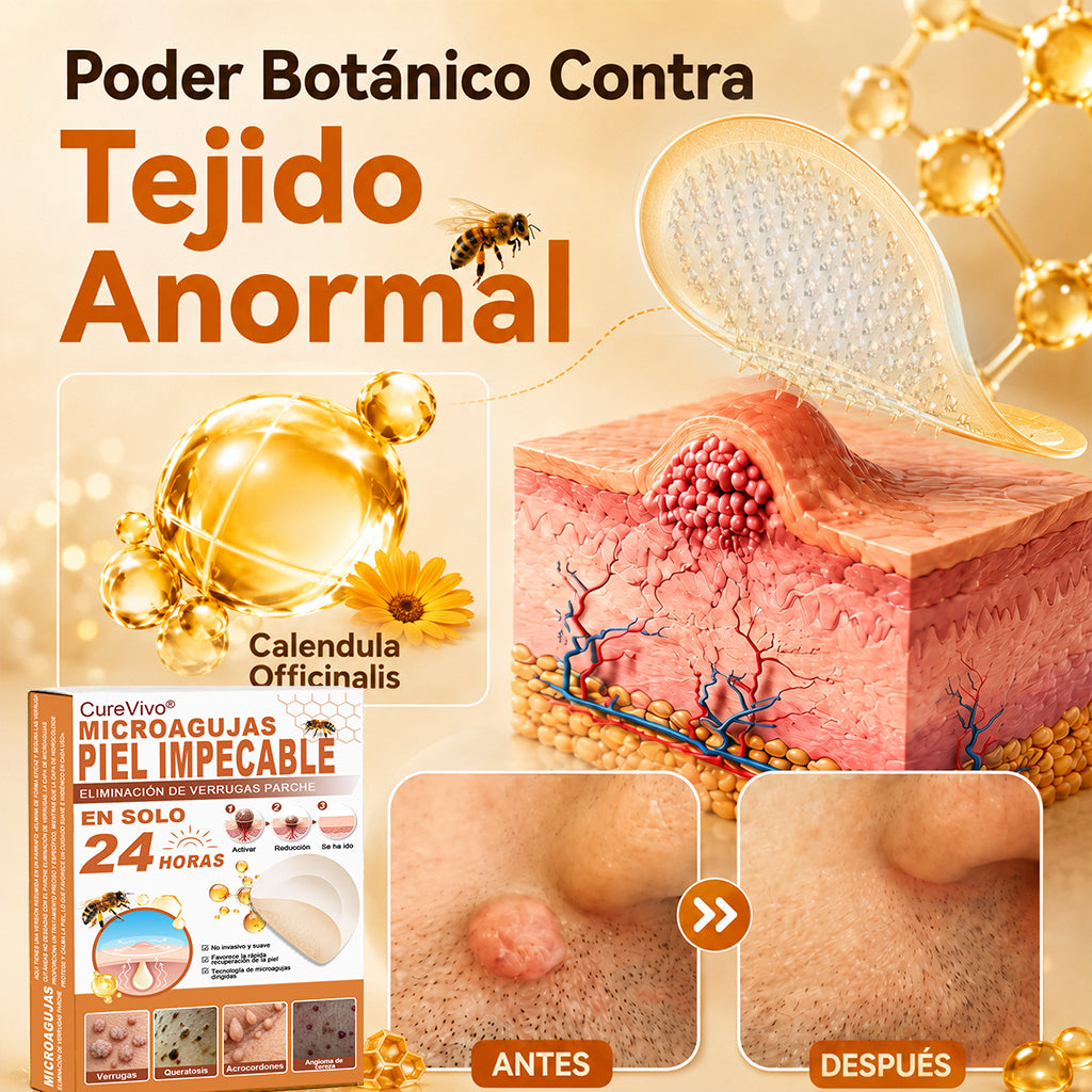 🍯Tienda oficial insignia | CureVivo® 🐝 Parche de microagujas con veneno de abeja (para verrugas, manchas de la edad e imperfecciones)💕