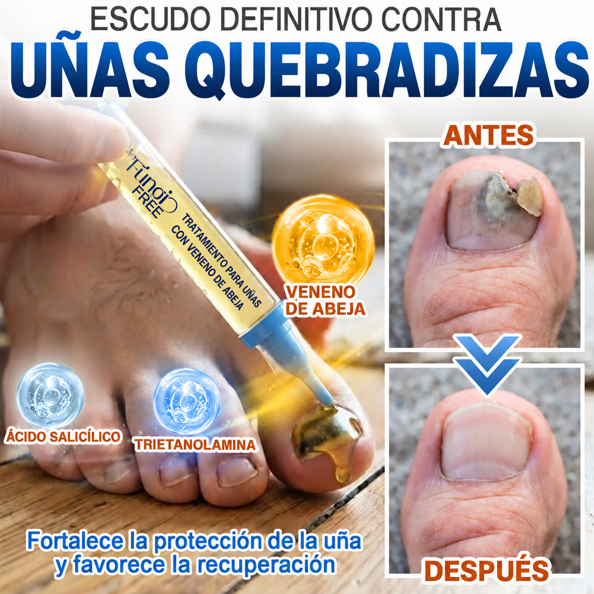 🇲🇽 Turonu® FungiFree 🐝 Cuidado Intensivo para Hongos, Uñas Amarillas, Gruesas y Quebradizas ✨