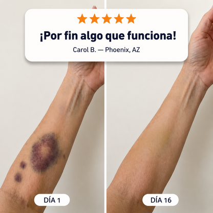 💥¡Más de 100,000 vendidos!💕- CureVivo® Crema Reparadora de Moretones y Fortalecedora de la Piel