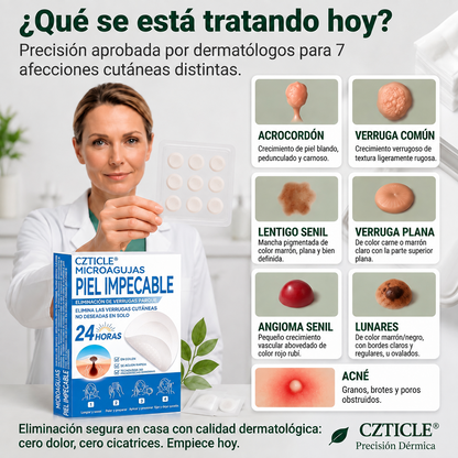👩‍⚕️🎉𝑻𝒊𝒆𝒏𝒅𝒂 𝑶𝒇𝒊𝒄𝒊𝒂𝒍 | CZTICLE® ☃️ 𝑀𝑖𝑐𝑟𝑜𝑎𝑔𝑢𝑗𝑎𝑠 𝑃𝑖𝑒𝑙 𝐼𝑚𝑝𝑒𝑐𝑎𝑏𝑙𝑒 𝐸𝑙𝑖𝑚𝑖𝑛𝑎𝑐𝑖ó𝑛 𝐷𝑒 𝑉𝑒𝑟𝑟𝑢𝑔𝑎𝑠 𝑃𝑎𝑟𝑐ℎ𝑒 (𝑃𝑎𝑟𝑎 𝑎𝑐𝑟𝑜𝑐𝑜𝑟𝑑𝑜𝑛𝑒𝑠, 𝑝𝑒𝑞𝑢𝑒ñ𝑎𝑠 𝑖𝑚𝑝𝑒𝑟𝑓𝑒𝑐𝑐𝑖𝑜𝑛𝑒𝑠 𝑐𝑢𝑡á𝑛𝑒𝑎𝑠, 𝑣𝑒𝑟𝑟𝑢𝑔𝑎𝑠, 𝑙𝑢𝑛𝑎𝑟𝑒𝑠, 𝑚𝑎𝑛𝑐ℎ𝑎𝑠 𝑑𝑒 𝑙𝑎 𝑒𝑑𝑎𝑑 𝑦 𝑝𝑟𝑜𝑏𝑙𝑒𝑚𝑎𝑠 𝑑𝑒 𝑝𝑖𝑔𝑚𝑒𝑛𝑡𝑎𝑐𝑖ó𝑛.)