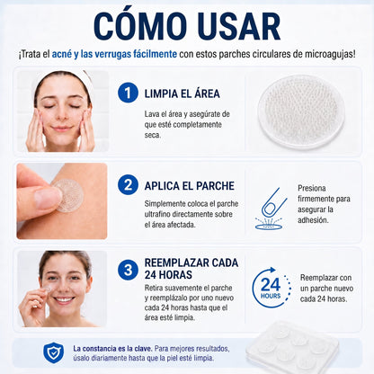 👩‍⚕️🎉𝑻𝒊𝒆𝒏𝒅𝒂 𝑶𝒇𝒊𝒄𝒊𝒂𝒍 | CZTICLE® ☃️ 𝑀𝑖𝑐𝑟𝑜𝑎𝑔𝑢𝑗𝑎𝑠 𝑃𝑖𝑒𝑙 𝐼𝑚𝑝𝑒𝑐𝑎𝑏𝑙𝑒 𝐸𝑙𝑖𝑚𝑖𝑛𝑎𝑐𝑖ó𝑛 𝐷𝑒 𝑉𝑒𝑟𝑟𝑢𝑔𝑎𝑠 𝑃𝑎𝑟𝑐ℎ𝑒 (𝑃𝑎𝑟𝑎 𝑎𝑐𝑟𝑜𝑐𝑜𝑟𝑑𝑜𝑛𝑒𝑠, 𝑝𝑒𝑞𝑢𝑒ñ𝑎𝑠 𝑖𝑚𝑝𝑒𝑟𝑓𝑒𝑐𝑐𝑖𝑜𝑛𝑒𝑠 𝑐𝑢𝑡á𝑛𝑒𝑎𝑠, 𝑣𝑒𝑟𝑟𝑢𝑔𝑎𝑠, 𝑙𝑢𝑛𝑎𝑟𝑒𝑠, 𝑚𝑎𝑛𝑐ℎ𝑎𝑠 𝑑𝑒 𝑙𝑎 𝑒𝑑𝑎𝑑 𝑦 𝑝𝑟𝑜𝑏𝑙𝑒𝑚𝑎𝑠 𝑑𝑒 𝑝𝑖𝑔𝑚𝑒𝑛𝑡𝑎𝑐𝑖ó𝑛.)